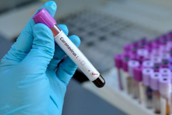 Azərbaycanda daha 40 nəfərdə koronavirus aşkarlandı - RƏSMİ